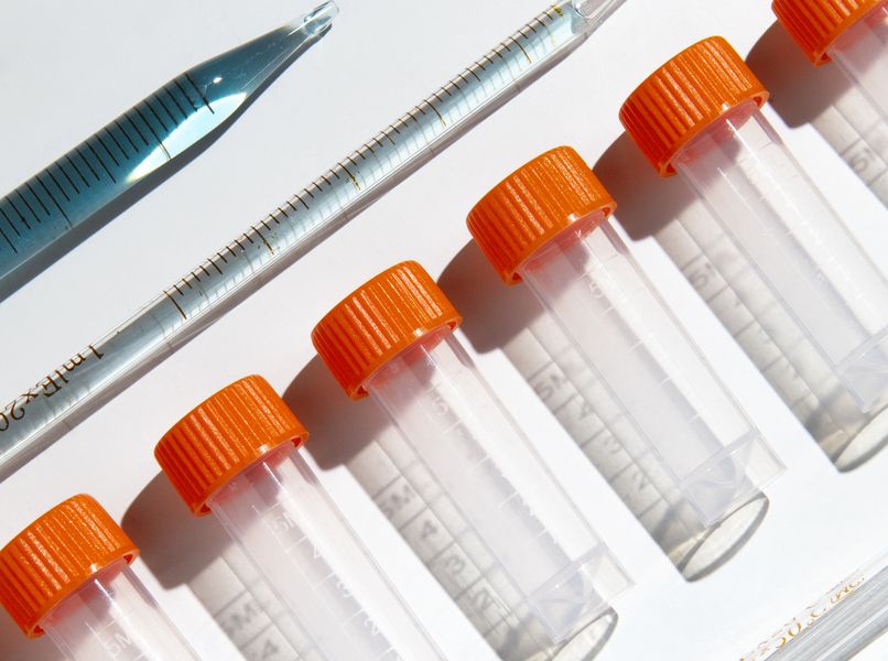 Serie di provette trasparenti con tappo arancione e pipetta graduata su fondo bianco, simbolo di analisi e controllo di laboratorio.